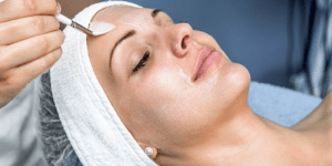 chemical peels