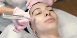 BENEFITS OF MICRONEEDLING